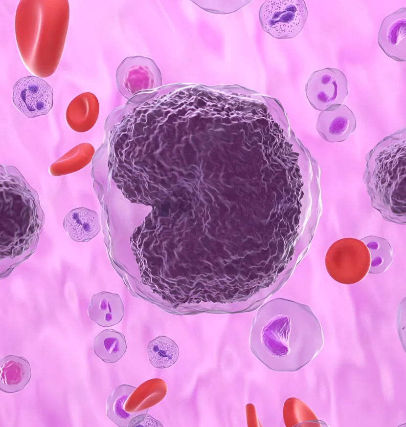 Non-Hodgkin's Lymphoma
